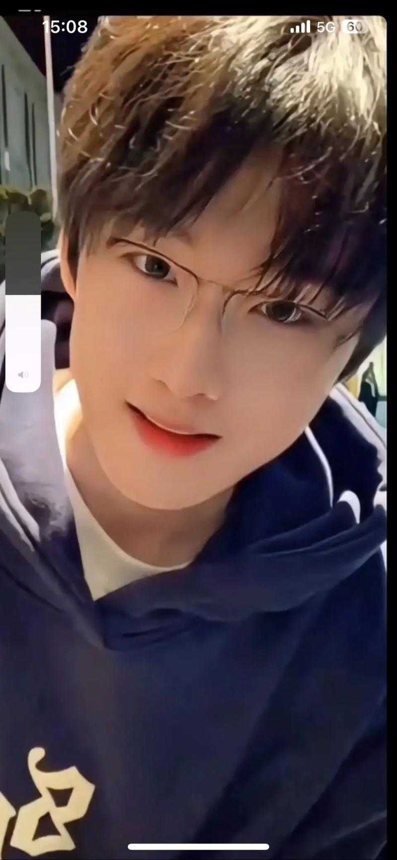张新伟照片惊现牙签撑眼内幕曝光