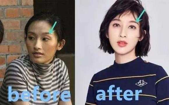 张俪整容前后对比照片曝光,她真的整过容吗?